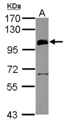 Western Blot: UHRF1 Antibody [NBP2-20806]