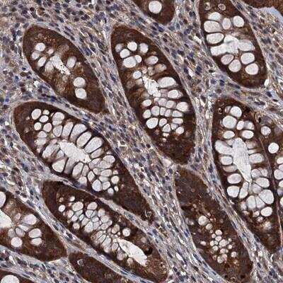 Immunohistochemistry-Paraffin: UHRF1BP1L Antibody [NBP1-81487]