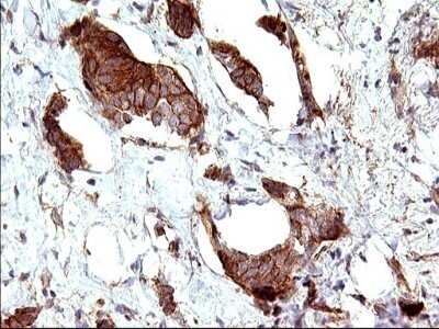 Immunohistochemistry: UIP1 Antibody (OTI1E8) - Azide and BSA Free [NBP2-74782]