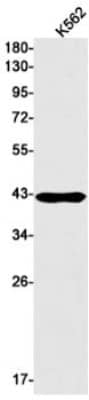 Western Blot: UIP1 Antibody (S05-9C8) [NBP3-19978]