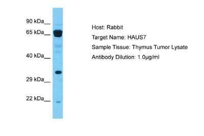 Western Blot: UIP1 Antibody [NBP2-86886]