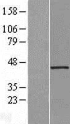 Western Blot: UIP1 Overexpression Lysate [NBL1-17578]