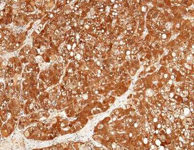Immunohistochemistry-Paraffin: ULBP-2 Antibody (022) [NBP2-90060]