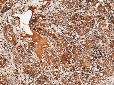 Immunohistochemistry-Paraffin: ULBP-2 Antibody (022) [NBP2-90060]