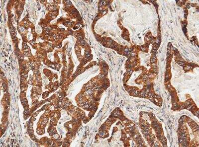 Immunohistochemistry-Paraffin: ULBP-2 Antibody (022) [NBP2-90060]