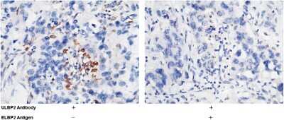 Immunohistochemistry-Paraffin: ULBP-2 Antibody [NBP2-99939]