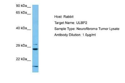 Western Blot: ULBP-2 Antibody [NBP2-86887]