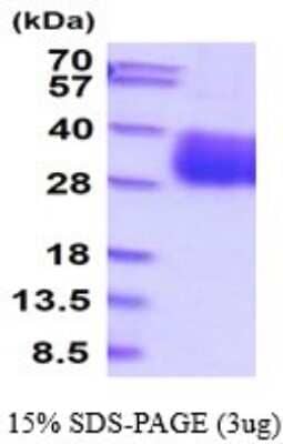 SDS-PAGE: Recombinant Mouse ULBP-4/RAET1E His Protein [NBP2-53053]