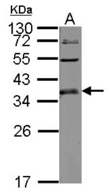 Western Blot: ULBP-1 Antibody [NBP2-20808]