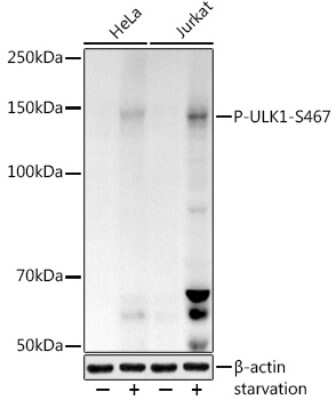 Western Blot: ULK1 [p Ser467] AntibodyAzide and BSA Free [NBP3-16957]