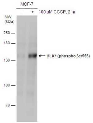 Western Blot: ULK1 [p Ser555] Antibody [NBP3-13124]