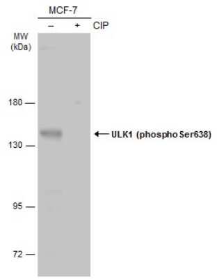 Western Blot: ULK1 [p Ser638] Antibody [NBP3-13254]