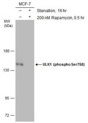 Western Blot: ULK1 [p Ser758] Antibody [NBP3-13123]