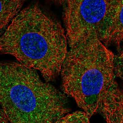 Immunocytochemistry/ Immunofluorescence: ULK1 Antibody [NBP2-56576]