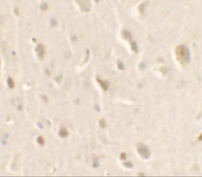 Immunohistochemistry-Paraffin: ULK1 Antibody - BSA Free [NBP2-41217]