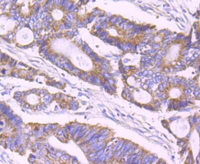 Immunohistochemistry-Paraffin: ULK1 Antibody (JA58-36) [NBP2-66765]