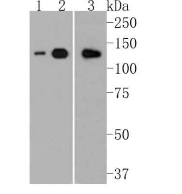 Western Blot: ULK1 Antibody (JA58-36) [NBP2-66765]