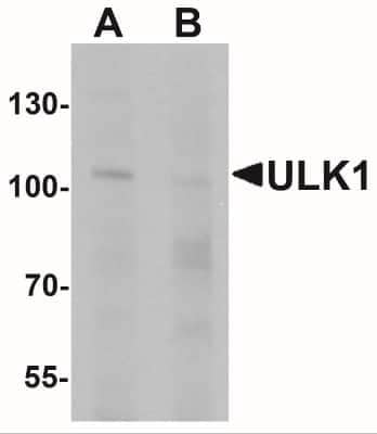 Western Blot: ULK1 AntibodyBSA Free [NBP2-41217]