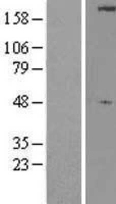 Western Blot: ULK1 Overexpression Lysate [NBL1-17607]