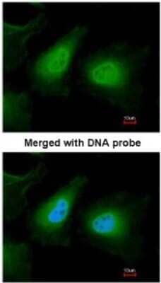 Immunocytochemistry/ Immunofluorescence: ULK2 Antibody [NBP1-33136]