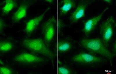 Immunocytochemistry/ Immunofluorescence: ULK2 Antibody [NBP1-33136]