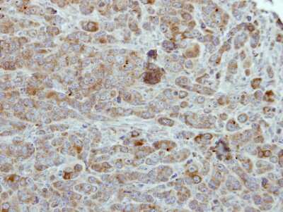 Immunohistochemistry-Paraffin: ULK2 Antibody [NBP1-33136]