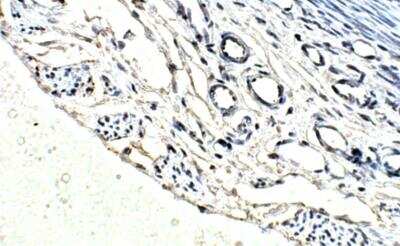 Immunohistochemistry-Paraffin: ULK2 Antibody [NBP3-12362]