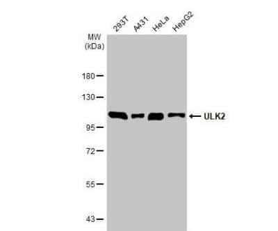 Western Blot: ULK2 Antibody [NBP1-33136]