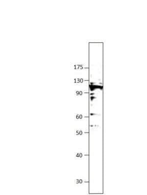 Western Blot: ULK2 Antibody [NBP3-12362]