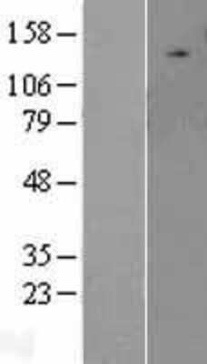 Western Blot: ULK2 Overexpression Lysate [NBL1-17608]