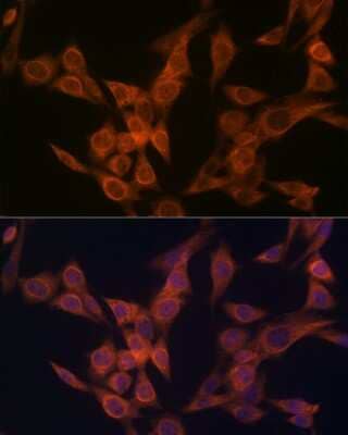 Immunocytochemistry/ Immunofluorescence: ULK3 Antibody (5Z7Z6) [NBP3-16622]