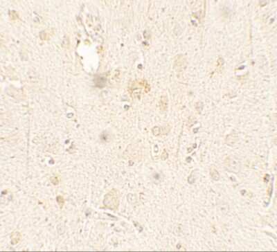 Immunohistochemistry: ULK3 Antibody - BSA Free [NBP2-41243]