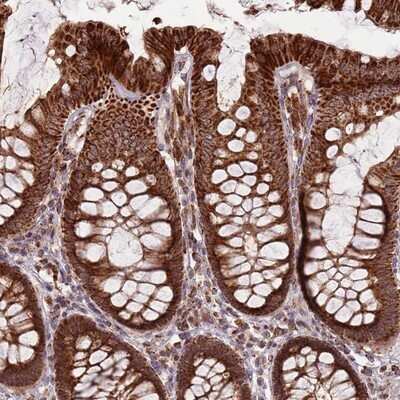 Immunohistochemistry-Paraffin: ULK3 Antibody [NBP2-13505]