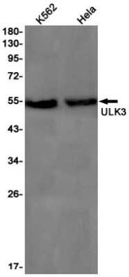 Western Blot: ULK3 Antibody (S08-7J3) [NBP3-15108]