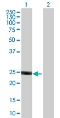 Western Blot: ULK3 Antibody [H00025989-B01P]