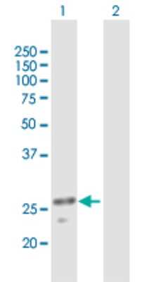 Western Blot: ULK3 Antibody [H00025989-B03P]