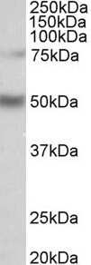 Western Blot: ULK3 Antibody [NBP1-97782]