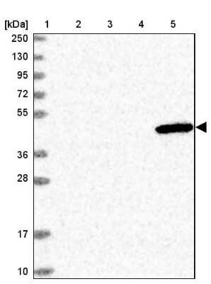 Western Blot: ULK3 Antibody [NBP2-13505]