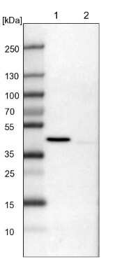 Western Blot: ULK3 Antibody [NBP2-13505]