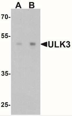 Western Blot: ULK3 AntibodyBSA Free [NBP2-41243]