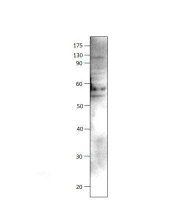 Western Blot: ULK3 Antibody [NBP3-12363]