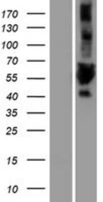 Western Blot: ULK3 Overexpression Lysate [NBP2-08281]