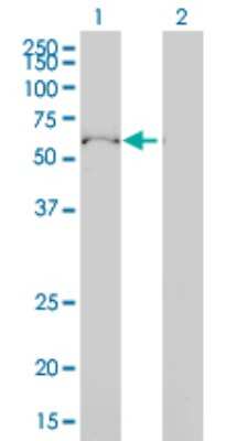 Western Blot: ULK4 Antibody (4A10-1A7) [H00054986-M01]