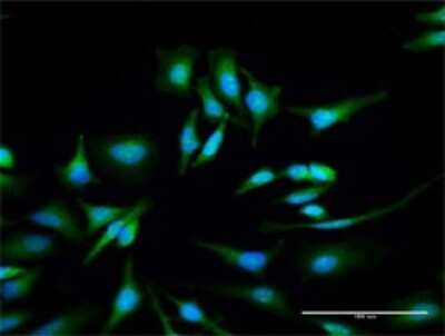 Immunocytochemistry/ Immunofluorescence: ULK4 Antibody [H00054986-D01P]