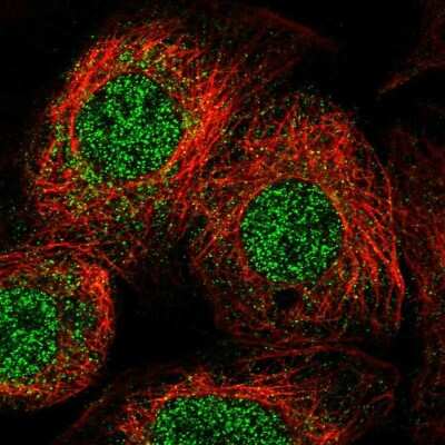 Immunocytochemistry/ Immunofluorescence: ULK4 Antibody [NBP1-84739]