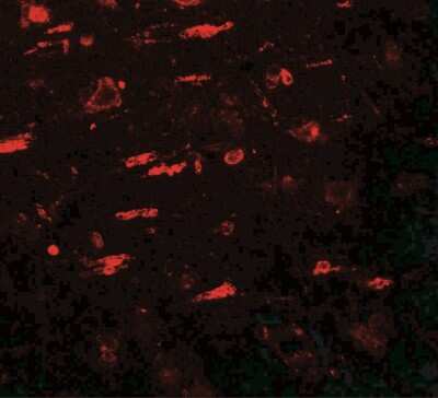 Immunocytochemistry/ Immunofluorescence: ULK4 Antibody - BSA Free [NBP2-41244]