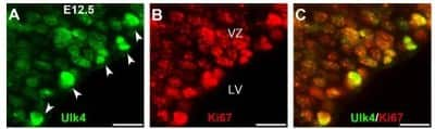 Immunocytochemistry/ Immunofluorescence: ULK4 Antibody [NBP1-20229]