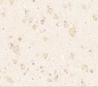 Immunohistochemistry: ULK4 Antibody - BSA Free [NBP2-41244]