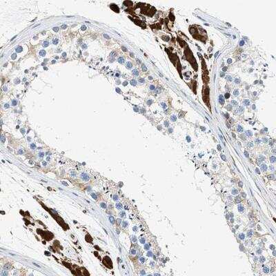 Immunohistochemistry-Paraffin: ULK4 Antibody [NBP1-84739]