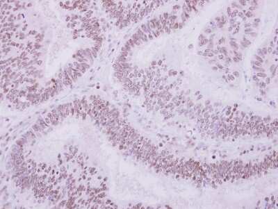 Immunohistochemistry-Paraffin: ULK4 Antibody [NBP2-20809]